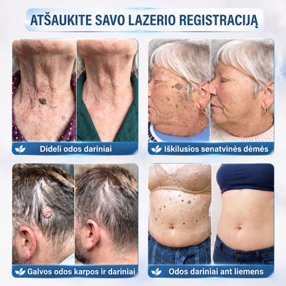 🐝🐝Oficiali parduotuvė | ✅️👩‍⚕️ 𝐇𝐈𝐒𝐊𝐈𝐍® 7 dienų odos išaugų ir dėmių šalinimo priemonė (𝐫𝐨𝐥𝐥-𝐨𝐧 𝐚𝐩𝐥𝐢𝐤𝐚𝐭𝐨𝐫𝐢𝐮𝐬: 𝐛𝐞 𝐬𝐤𝐚𝐮𝐬𝐦𝐨 𝐢𝐫 𝐫𝐚𝐧𝐝ų) 🌳