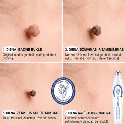 🐝🐝Oficiali parduotuvė | ✅️👩‍⚕️ 𝐇𝐈𝐒𝐊𝐈𝐍® 7 dienų odos išaugų ir dėmių šalinimo priemonė (𝐫𝐨𝐥𝐥-𝐨𝐧 𝐚𝐩𝐥𝐢𝐤𝐚𝐭𝐨𝐫𝐢𝐮𝐬: 𝐛𝐞 𝐬𝐤𝐚𝐮𝐬𝐦𝐨 𝐢𝐫 𝐫𝐚𝐧𝐝ų) 🌳