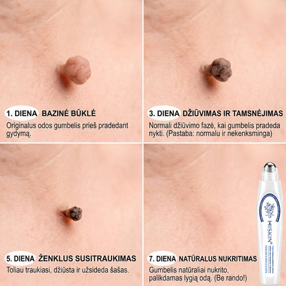 🪶💙Oficiali parduotuvė | ✅️👩‍⚕️ 𝐇𝐈𝐒𝐊𝐈𝐍® 7 dienų odos išaugų ir dėmių šalinimo priemonė (𝐫𝐨𝐥𝐥-𝐨𝐧 𝐚𝐩𝐥𝐢𝐤𝐚𝐭𝐨𝐫𝐢𝐮𝐬: 𝐛𝐞 𝐬𝐤𝐚𝐮𝐬𝐦𝐨 𝐢𝐫 𝐫𝐚𝐧𝐝ų) 🌳
