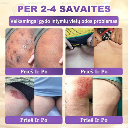 💥Gaminta ir išsiųsta iš Europos ✨ 𝐆𝐎𝐋𝐃𝐊𝐈𝐒𝐒® 𝐆𝐇𝐊-𝐂𝐮 & 𝐁𝐈𝐎𝐓𝐈𝐍 𝟏𝟎-𝐁-𝟏 Odos atstatymo kremas