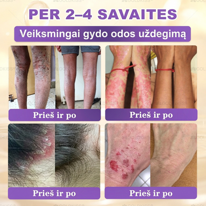 💥Gaminta ir išsiųsta iš Europos ✨ 𝐆𝐎𝐋𝐃𝐊𝐈𝐒𝐒® 𝐆𝐇𝐊-𝐂𝐮 & 𝐁𝐈𝐎𝐓𝐈𝐍 𝟏𝟎-𝐁-𝟏 Odos atstatymo kremas