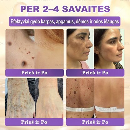 💥Gaminta ir išsiųsta iš Europos ✨ 𝐆𝐎𝐋𝐃𝐊𝐈𝐒𝐒® 𝐆𝐇𝐊-𝐂𝐮 & 𝐁𝐈𝐎𝐓𝐈𝐍 𝟏𝟎-𝐁-𝟏 Odos atstatymo kremas