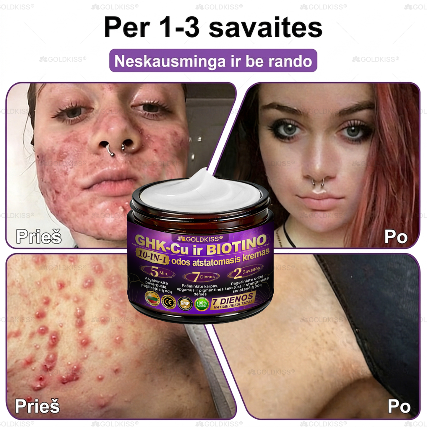 💥Gaminta ir išsiųsta iš Europos ✨ 𝐆𝐎𝐋𝐃𝐊𝐈𝐒𝐒® 𝐆𝐇𝐊-𝐂𝐮 & 𝐁𝐈𝐎𝐓𝐈𝐍 𝟏𝟎-𝐁-𝟏 Odos atstatymo kremas