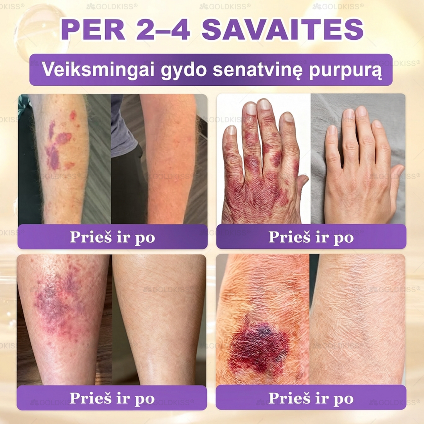 💥Gaminta ir išsiųsta iš Europos ✨ 𝐆𝐎𝐋𝐃𝐊𝐈𝐒𝐒® 𝐆𝐇𝐊-𝐂𝐮 & 𝐁𝐈𝐎𝐓𝐈𝐍 𝟏𝟎-𝐁-𝟏 Odos atstatymo kremas