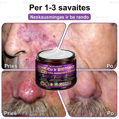 💥Gaminta ir išsiųsta iš Europos ✨ 𝐆𝐎𝐋𝐃𝐊𝐈𝐒𝐒® 𝐆𝐇𝐊-𝐂𝐮 & 𝐁𝐈𝐎𝐓𝐈𝐍 𝟏𝟎-𝐁-𝟏 Odos atstatymo kremas