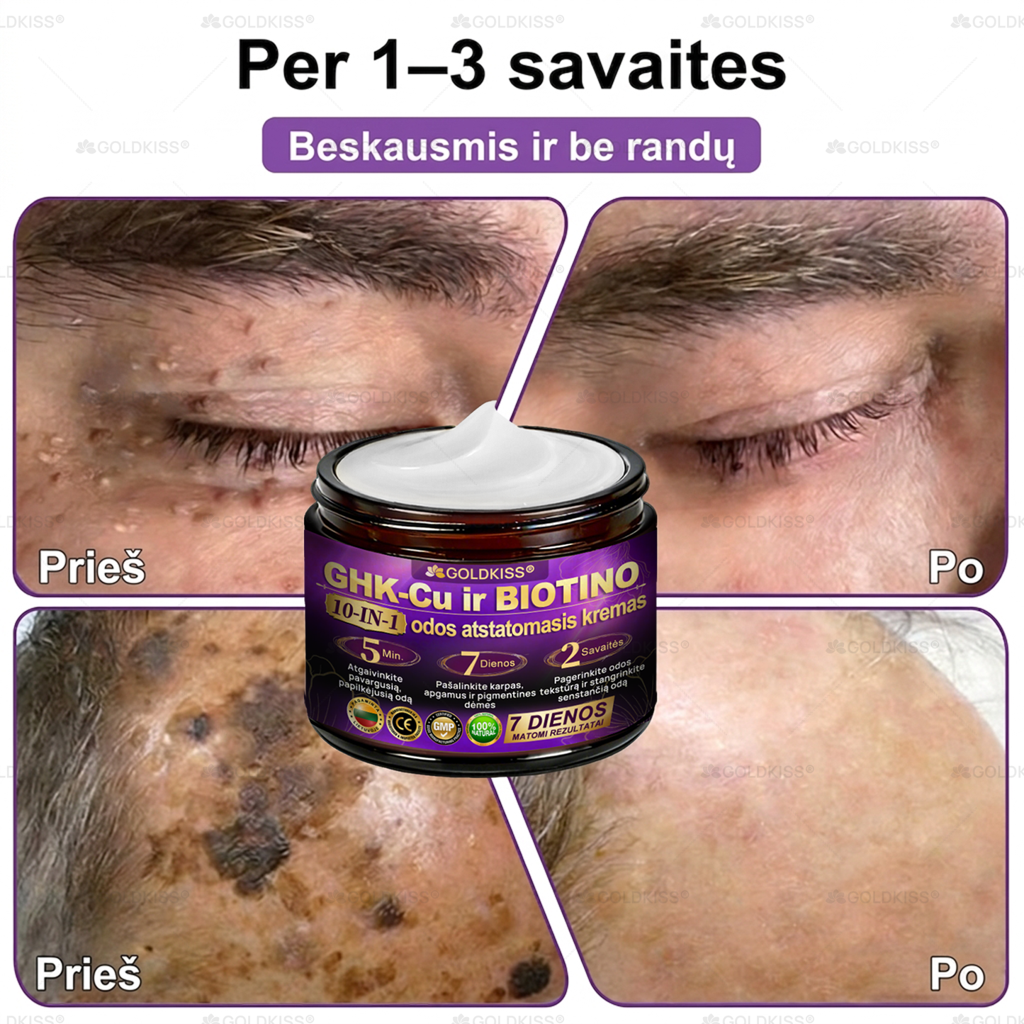 💥Gaminta ir išsiųsta iš Europos ✨ 𝐆𝐎𝐋𝐃𝐊𝐈𝐒𝐒® 𝐆𝐇𝐊-𝐂𝐮 & 𝐁𝐈𝐎𝐓𝐈𝐍 𝟏𝟎-𝐁-𝟏 Odos atstatymo kremas