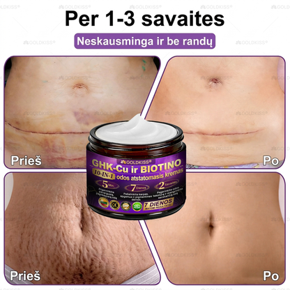 💥Gaminta ir išsiųsta iš Europos ✨ 𝐆𝐎𝐋𝐃𝐊𝐈𝐒𝐒® 𝐆𝐇𝐊-𝐂𝐮 & 𝐁𝐈𝐎𝐓𝐈𝐍 𝟏𝟎-𝐁-𝟏 Odos atstatymo kremas